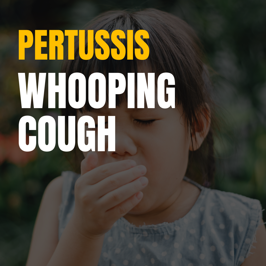 Pertussis 
